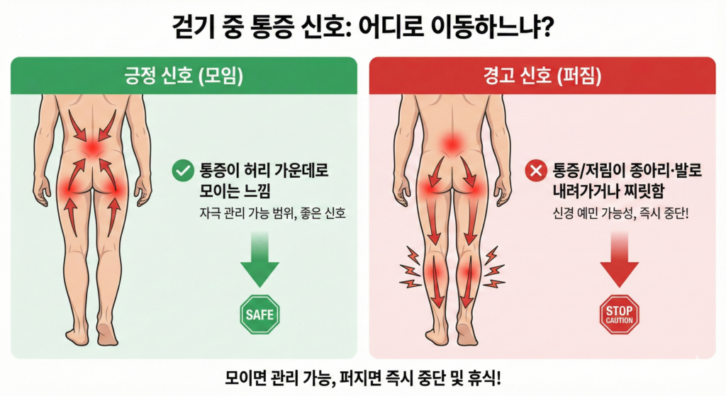 걷기 중 통증이 허리로 모이면 긍정 신호, 다리로 퍼지면 경고 신호를 비교한 그림