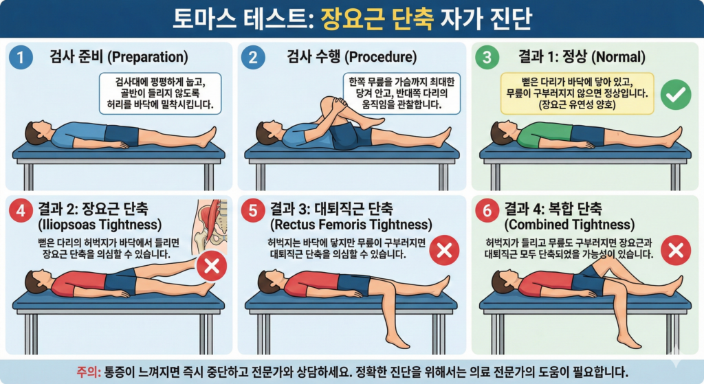장요근 단축을 의심해볼 수 있는 토마스 테스트 자세를 설명하는 인포그래픽